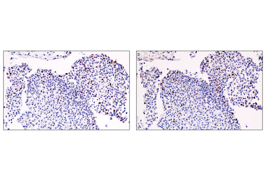 Immunohistochemistry Image 1: ATAD2 (E8Y2K) Rabbit Monoclonal Antibody