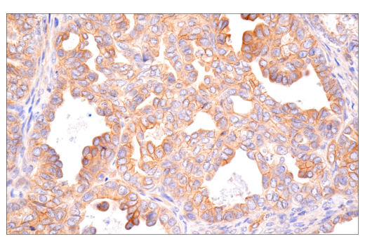 Immunohistochemistry Image 6: MYPT1 (D6C1) Rabbit Monoclonal Antibody (BSA and Azide Free)