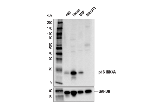 Western Blotting Image 3: p16 INK4A (E5F3Y) Rabbit Monoclonal Antibody