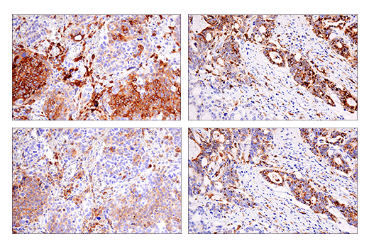 Immunohistochemistry Image 6: HLA-DRA (E9R2Q) XP<sup>®</sup> Rabbit mAb (BSA and Azide Free)