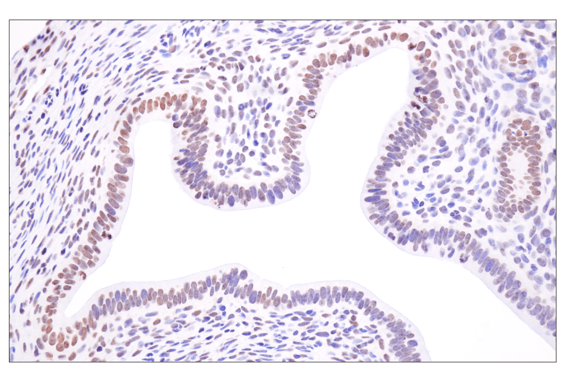 Immunohistochemistry Image 12: Acetyl-Histone H4 (Lys16) (E2B8W) Rabbit Monoclonal Antibody (BSA and Azide Free)