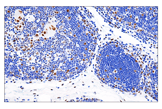 Immunohistochemistry Image 4: PML (E6S9L) Rabbit Monoclonal Antibody