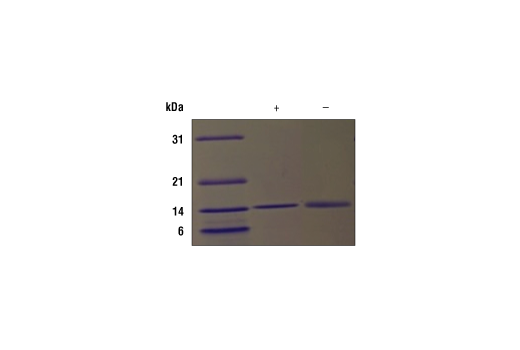 undefined Image 2: Human FLT3L Recombinant Protein