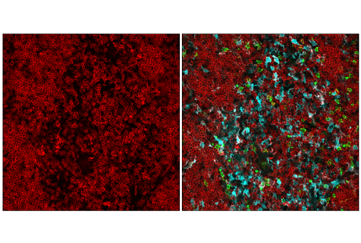 Confocal immunofluorescent analysis of fixed frozen mouse thymus labeled with CD4 (RM4-5) Rat mAb (redFluor™710 Conjugate) #75508 (red, left) and colabeled with CD45R/B220 (RA3-6B2) Rat mAb (FITC Conjugate) #34399 (green, right) and Iba1/AIF-1 (E4O4W) XP® Rabbit mAb (Alexa Fluor® 555 Conjugate) #36618 (cyan pseudocolor, right).