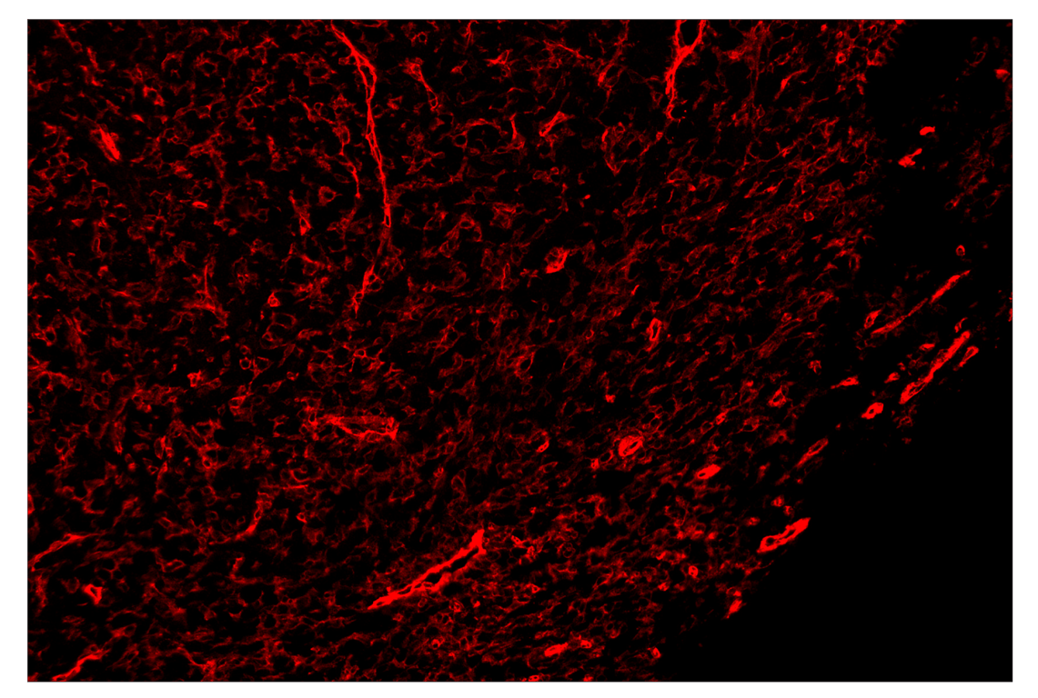 Immunohistochemistry Image 4: CD39/NTPDase 1 (E2X6B) & CO-0076-647 SignalStar<sup>™</sup> Oligo-Antibody Pair