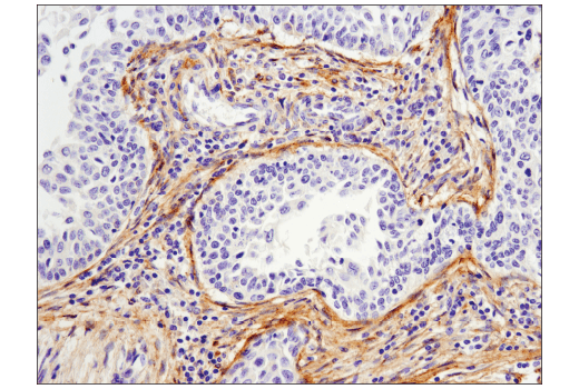 Immunohistochemistry Image 3: MMP-2 (D4M2N) Rabbit Monoclonal Antibody (BSA and Azide Free)