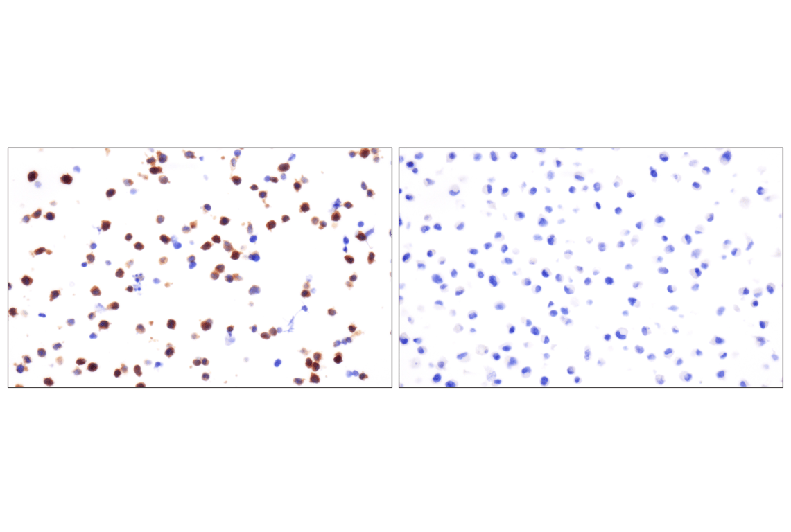 Immunohistochemistry Image 14: Phospho-Tau (Ser396) (F3S9T) Rabbit Monoclonal Antibody