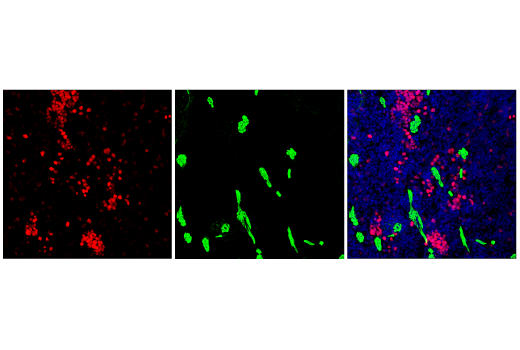 Immunofluorescence Image 2: Ki-67 (D3B5) Rabbit Monoclonal Antibody (Alexa Fluor<sup>®</sup> 555 Conjugate)