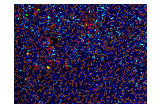 Immunohistochemistry Image 4: CD3 epsilon (D4V8L) Rabbit Monoclonal Antibody (BSA and Azide Free)