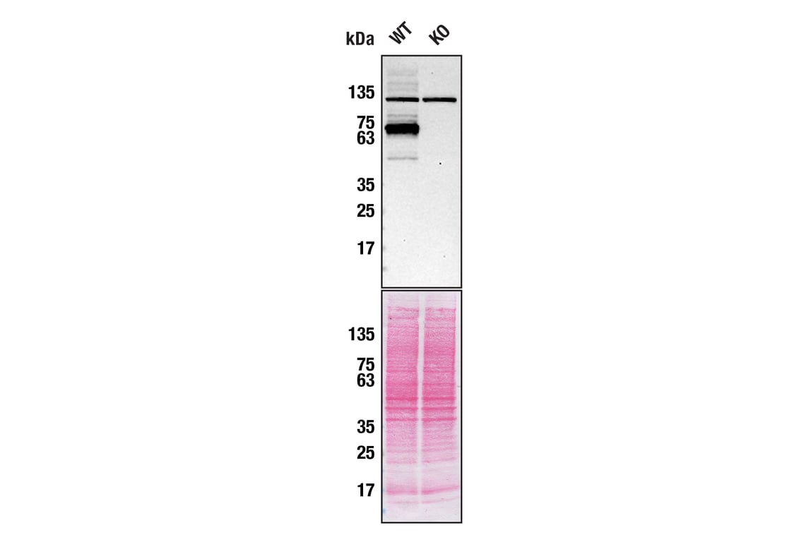 undefined Image 4: PhosphoPlus<sup>®</sup> Optineurin (Ser177) Antibody Duet