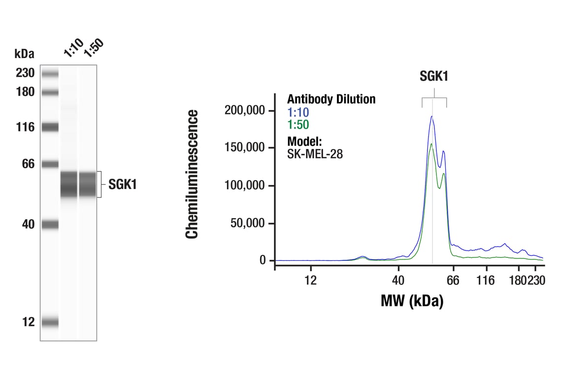 Western Blotting Image 1: SGK1 (D27C11) Rabbit Monoclonal Antibody