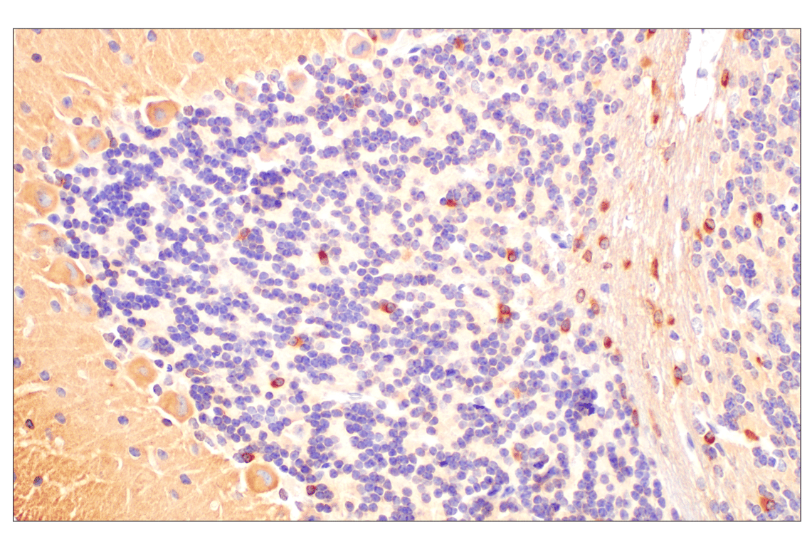 Immunohistochemistry Image 5: Phospho-Tau (Ser202) (F2A2F) Rabbit Monoclonal Antibody