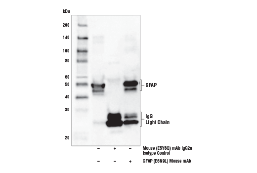 undefined Image 20: beta-Amyloid Mouse Model Neuronal Viability IF Antibody Sampler Kit