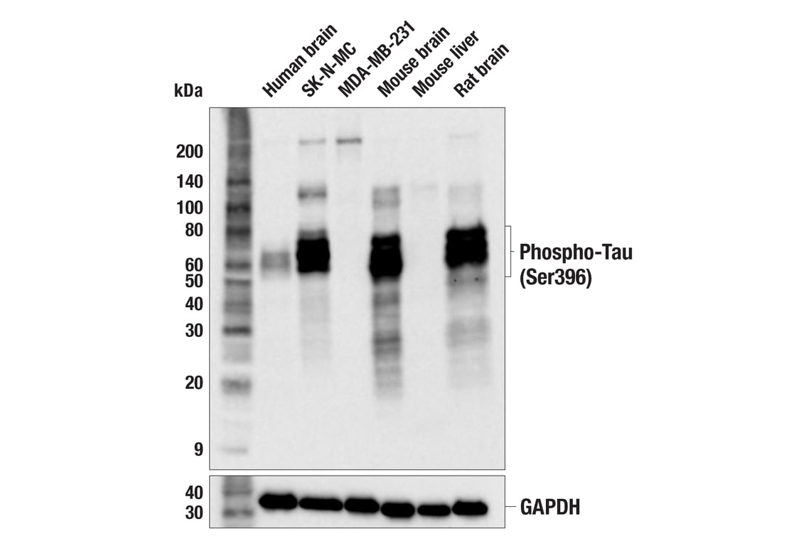 Western Blotting Image 3: Phospho-Tau (Ser396) (F3S9T) Rabbit Monoclonal Antibody