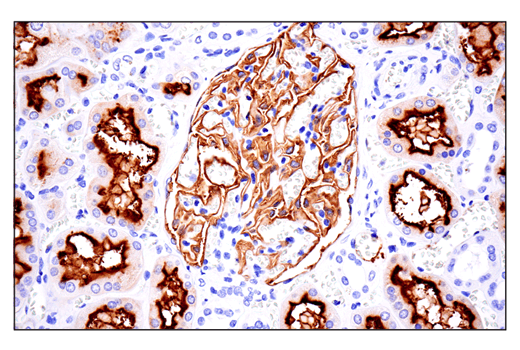 Immunohistochemistry Image 2: CD10/Neprilysin (E5P7S) Rabbit Monoclonal Antibody (BSA and Azide Free)