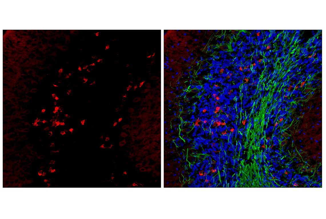 Immunofluorescence Image 1: TRPC3 (D4P5S) Rabbit Monoclonal Antibody