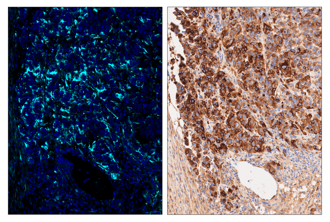 Immunohistochemistry Image 5: beta3-Tubulin (E9F3E) & CO-0128-750 SignalStar<sup>™</sup> Oligo-Antibody Pair