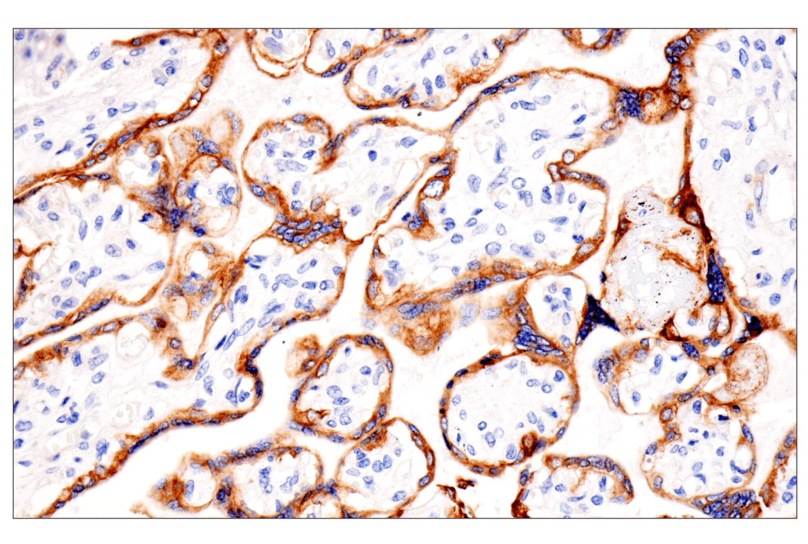 Immunohistochemistry Image 12: Pan-Keratin (Type II) (F6G1P) Rabbit Monoclonal Antibody