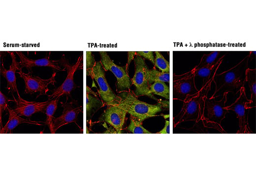 Immunofluorescence Image 1: Phospho-p90RSK (Ser380) (D3H11) Rabbit mAb (BSA and Azide Free)