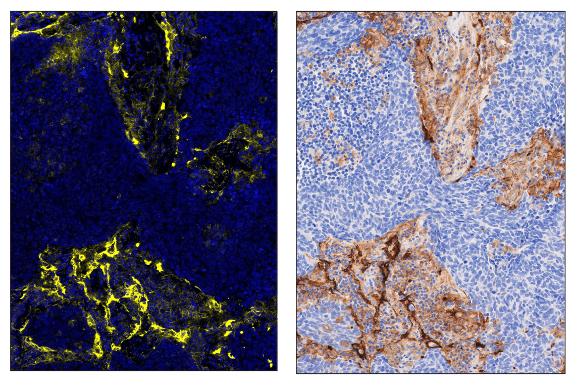 Immunohistochemistry Image 6: CD54/ICAM-1 (E3Q9N) & CO-0146-594 SignalStar<sup>™</sup> Oligo-Antibody Pair