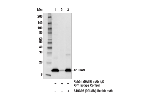 Immunoprecipitation Image 1: S100A9 (D3U8M) Rabbit Monoclonal Antibody