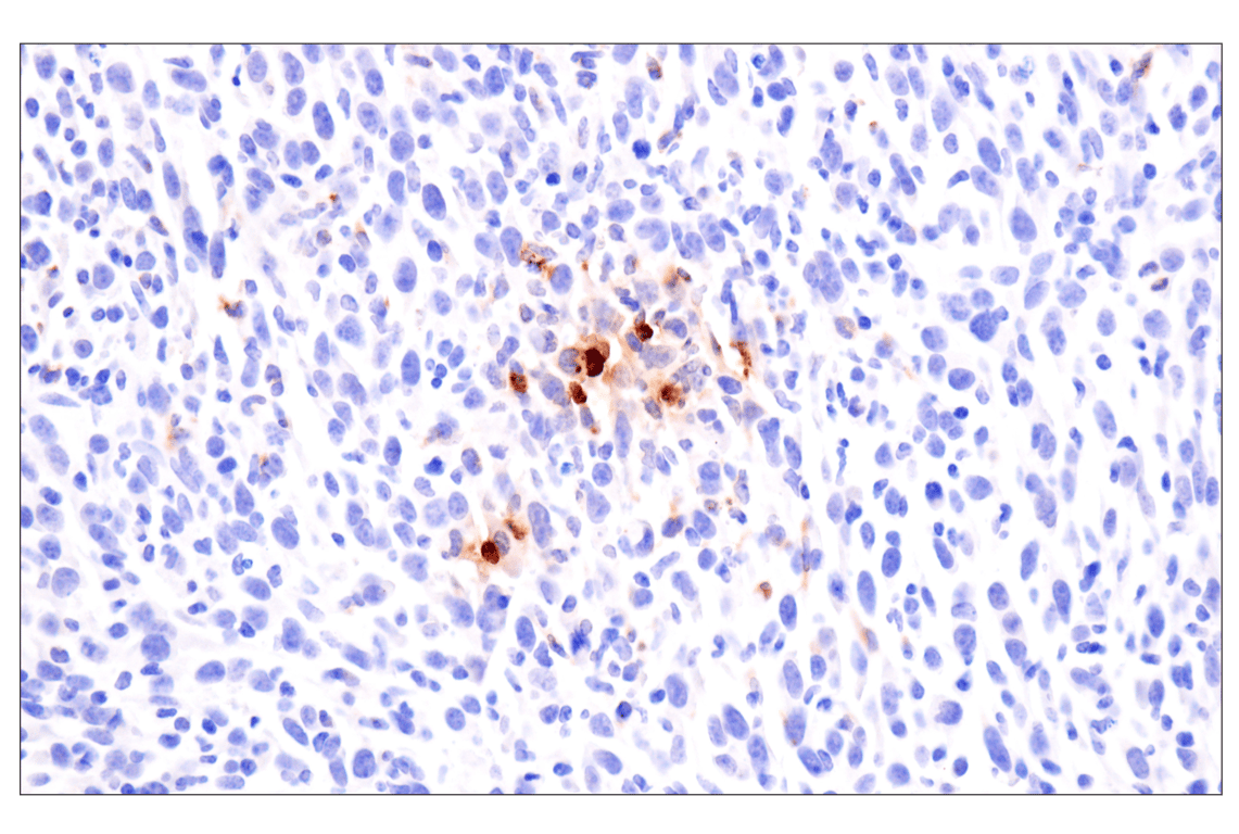 Immunohistochemistry Image 3: Eosinophil cationic protein (F3G7N) Rabbit Monoclonal Antibody
