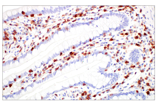 Immunohistochemistry Image 2: CD7 (E4G1Q) Rabbit Monoclonal Antibody (BSA and Azide Free)