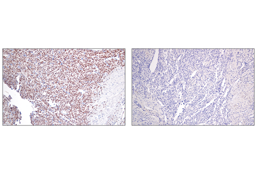 Immunohistochemistry Image 3: SS18-SSX (E9X9V) Rabbit Monoclonal Antibody