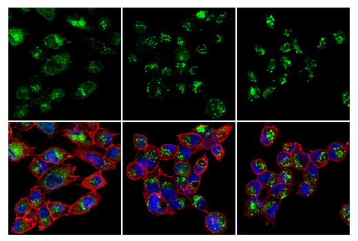 undefined Image 48: Xenophagy Antibody Sampler Kit