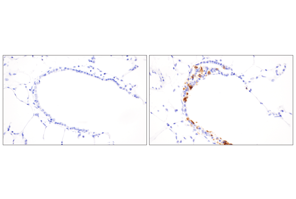 Immunohistochemistry Image 1: Respiratory Syncytial Virus (RSV) Nucleoprotein (N) (F5S9J) Rabbit Monoclonal Antibody