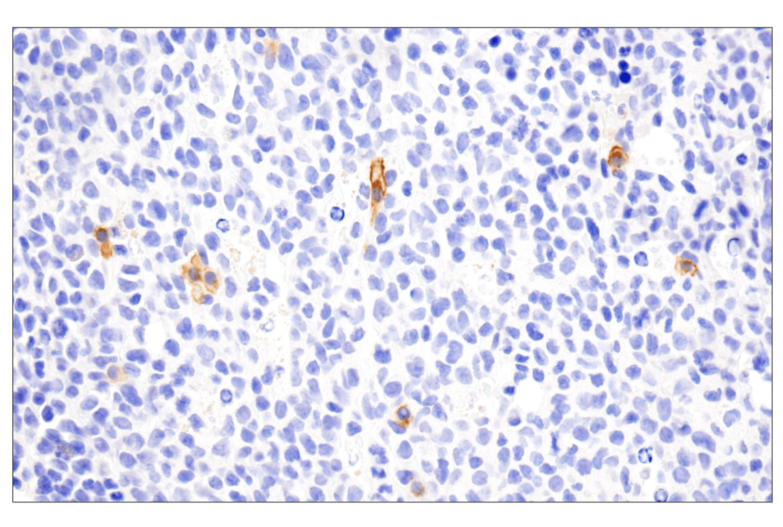 Immunohistochemistry Image 1: TNFRSF17/BCMA (E6D7B) Rabbit Monoclonal Antibody