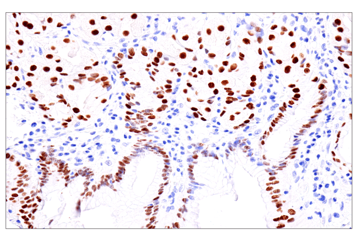 Immunohistochemistry Image 8: GATA-6 (D61E4) Rabbit Monoclonal Antibody