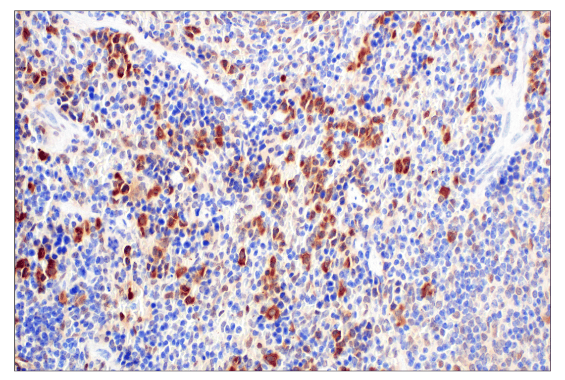 Immunohistochemistry Image 7: CDK4 (F8L5F) Rabbit Monoclonal Antibody