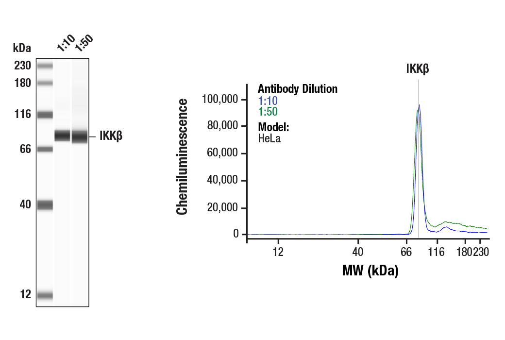 Western Blotting Image 1: IKK beta (2C8) Rabbit Monoclonal Antibody