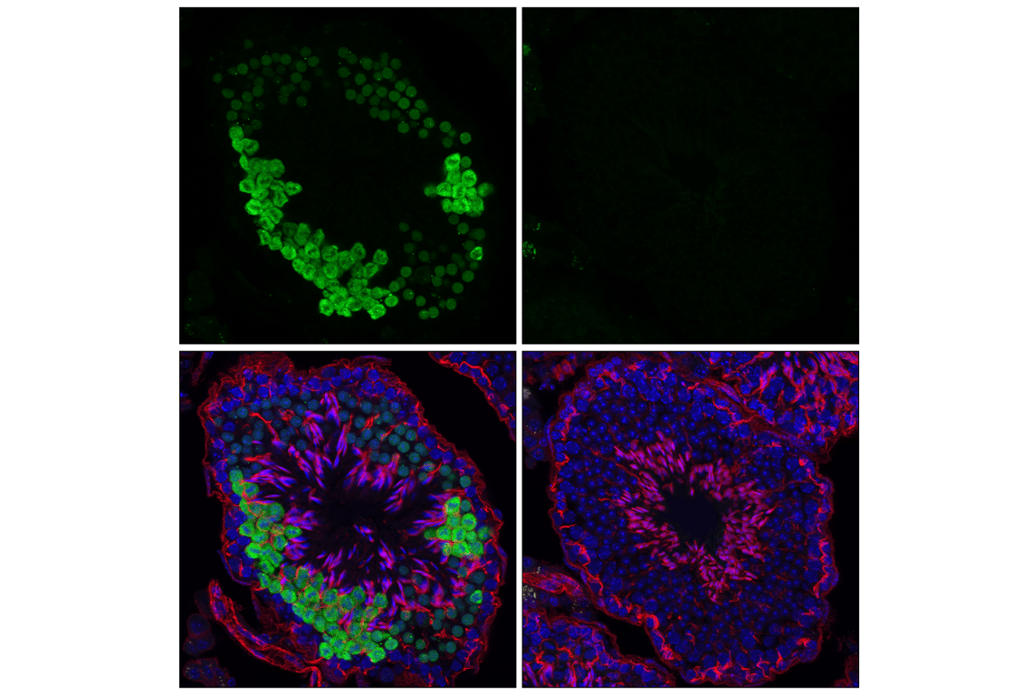 Immunofluorescence Image 2: Phospho-NPM1 (Thr199) (E4C7S) Rabbit Monoclonal Antibody