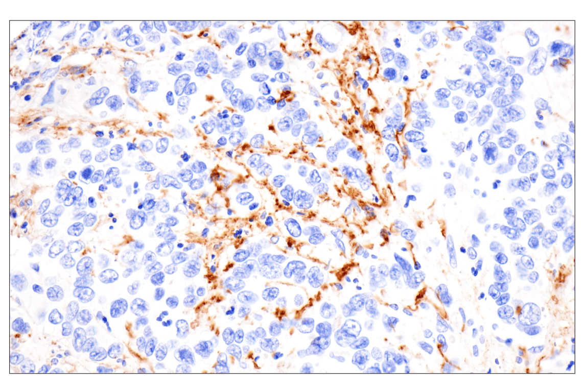 Immunohistochemistry Image 6: Vitronectin (F8D3L) Rabbit Monoclonal Antibody