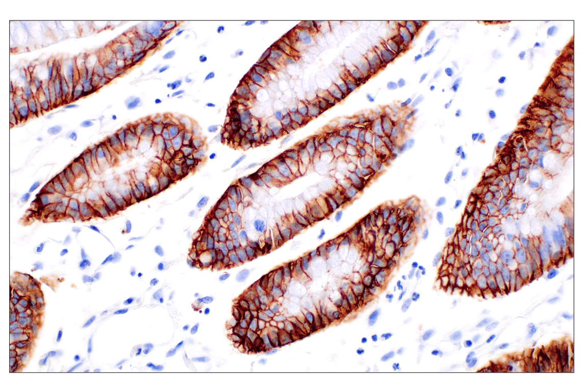 Immunohistochemistry Image 5: EpCAM (D9S3P) Rabbit Monoclonal Antibody