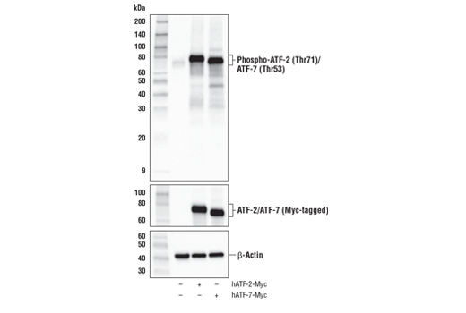 undefined Image 4: Phospho-SAPK/JNK Pathway Antibody Sampler Kit
