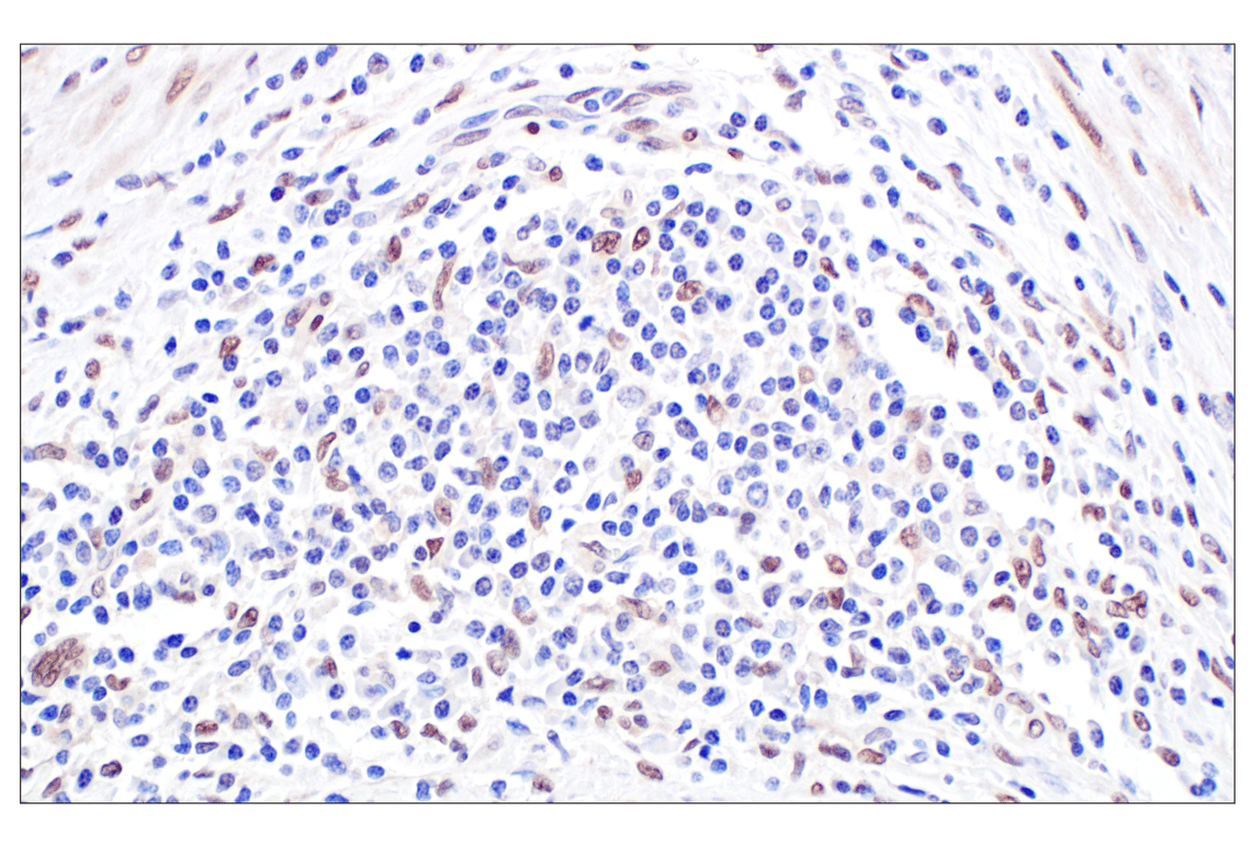 Immunohistochemistry Image 3: TFE3 (F3Z2Q) Rabbit Monoclonal Antibody