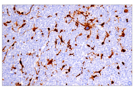 Immunohistochemistry Image 10: Galectin-3/LGALS3 (E7B6R) Rabbit Monoclonal Antibody