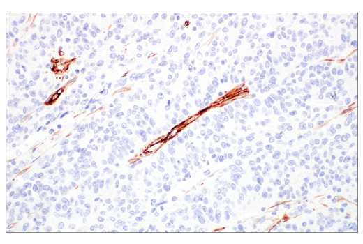 Immunohistochemistry Image 5: Nestin (E4O9E) XP<sup>®</sup> Rabbit mAb