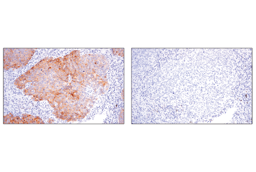 undefined Image 32: p62/KEAP1/NRF2 Pathway Antibody Sampler Kit