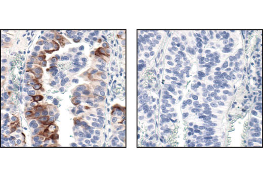 Immunohistochemistry Image 1: Phospho-mTOR (Ser2448) (49F9) Rabbit mAb (BSA and Azide Free)