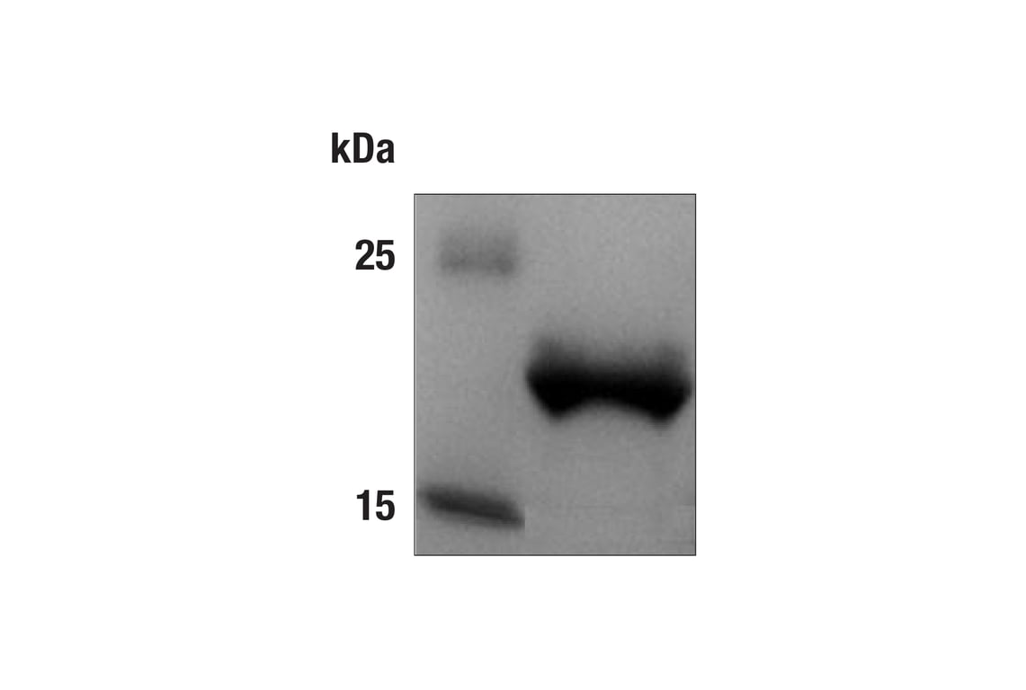 undefined Image 1: Human IFN-α1 Recombinant Protein