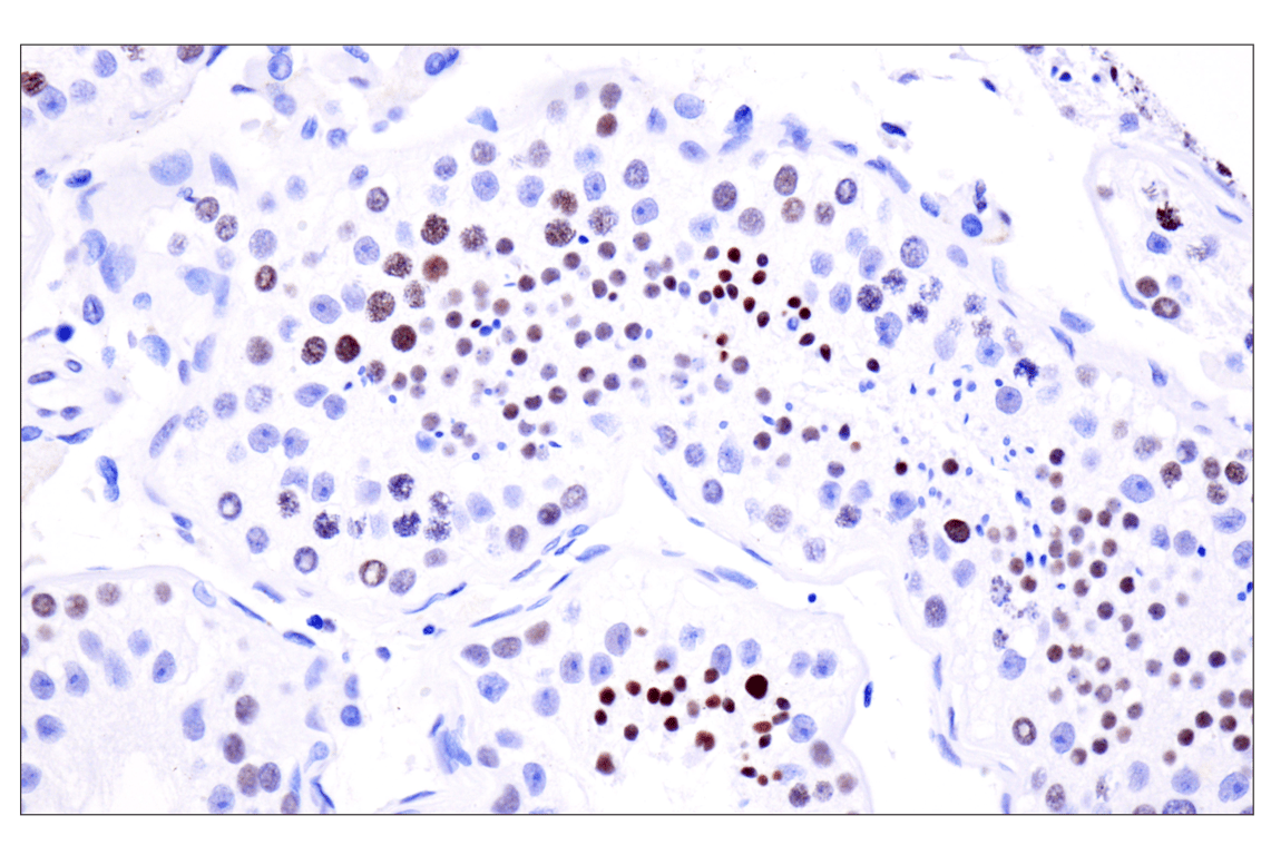 Immunohistochemistry Image 7: Acetyl-Histone H4 (Lys16) (E2B8W) Rabbit Monoclonal Antibody