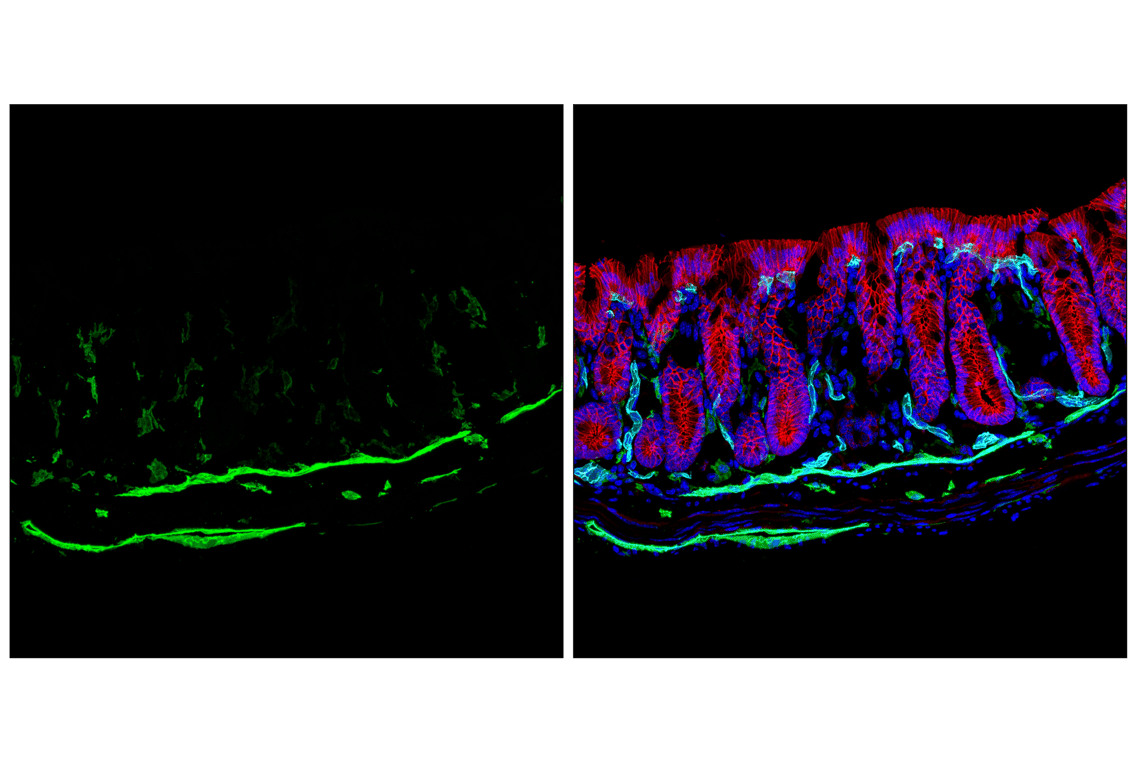 Immunofluorescence Image 1: LYVE-1 (E5P8S) Rabbit Monoclonal Antibody