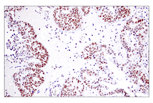 Immunohistochemistry Image 2: EED (E4L6E) Rabbit Monoclonal Antibody