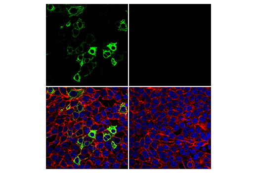 Immunofluorescence Image 1: SARS-CoV-1/2 Spike Protein (2B3E5) Mouse Monoclonal Antibody