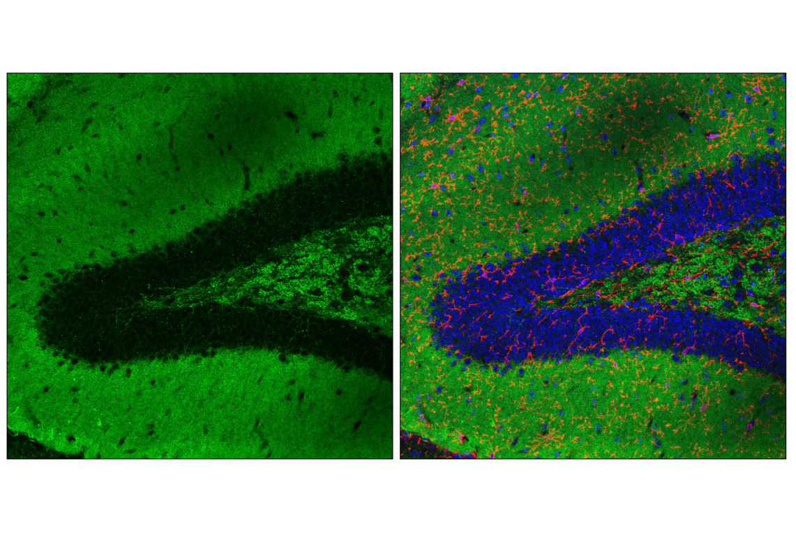 Immunofluorescence Image 2: SHANK2 (E2J1N) Rabbit Monoclonal Antibody
