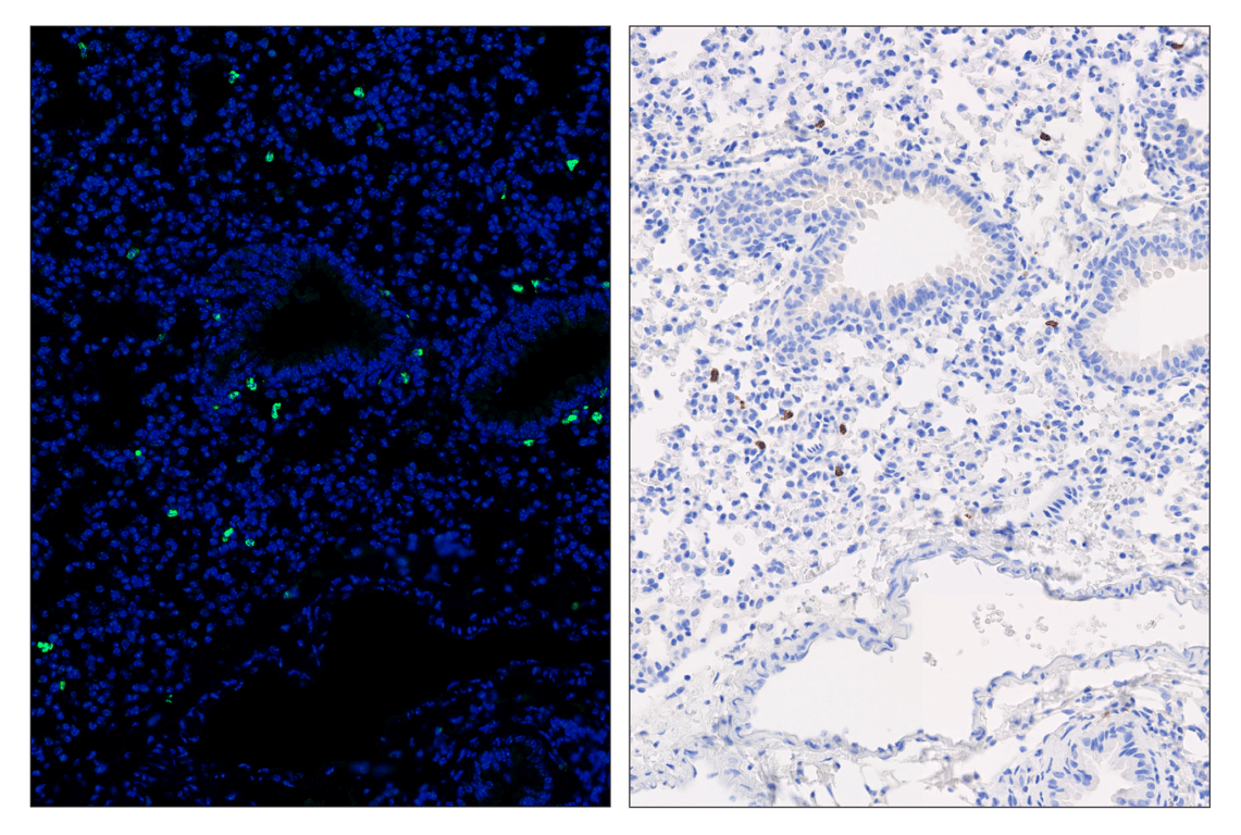 Immunohistochemistry Image 6: CD8 alpha (D4W2Z) & CO-0040-594 SignalStar<sup>™</sup> Oligo-Antibody Pair